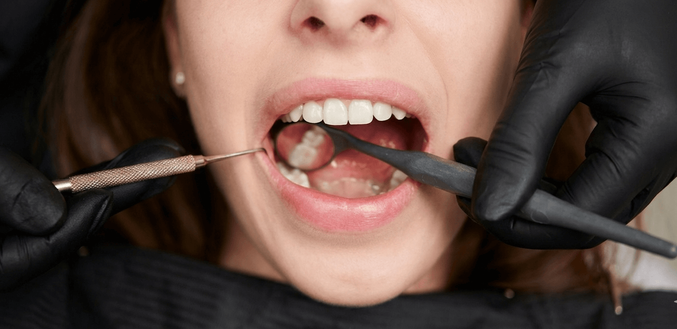 A close-up photograph of a patient undergoing periodontic treatment, showing a dentist using a periodontal probe and mirror to examine the gums and teeth.
