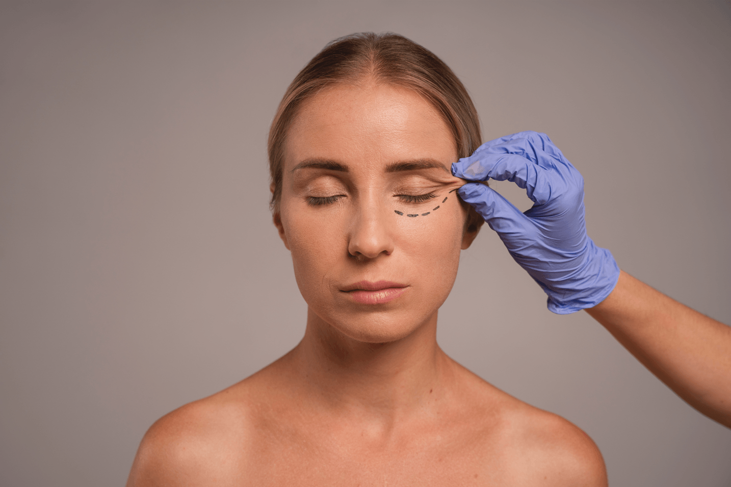 Woman preparing for blepharoplasty in brazil procedure