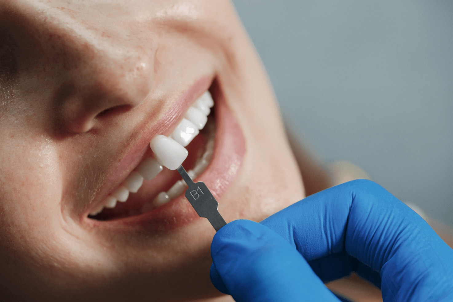 patient using Dental implants in Brazil