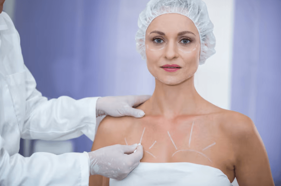 patient preparing for a mastopexy in brazil