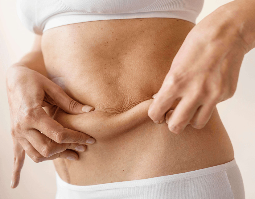 patient preparing to undergo a tummy tuck procedure after understanding the tummy tuck recovery timeline